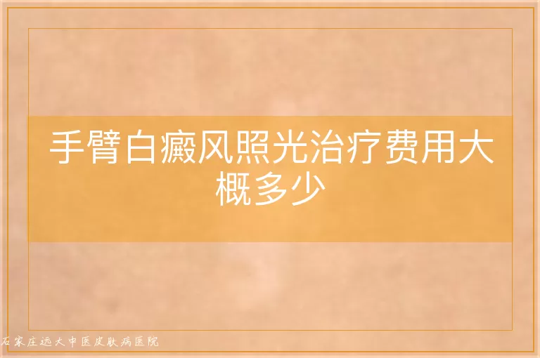 手臂白癜风照光治疗费用大概多少