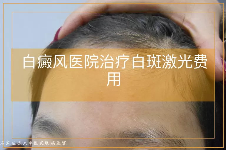 白癜风医院治疗白斑激光费用