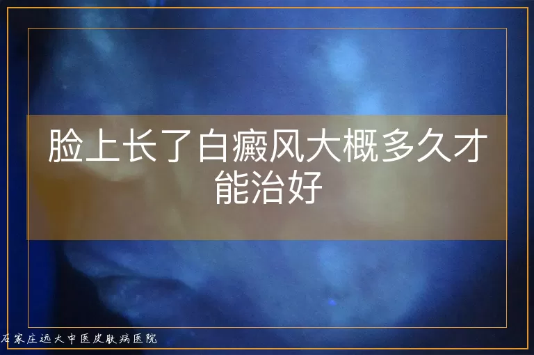 脸上长了白癜风大概多久才能治好