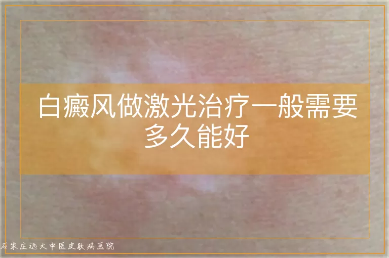 白癜风做激光治疗一般需要多久能好