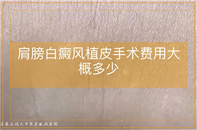 肩膀白癜风植皮手术费用大概多少