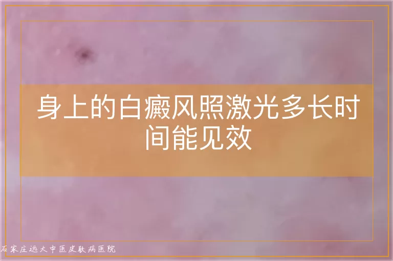 身上的白癜风照激光多长时间能见效