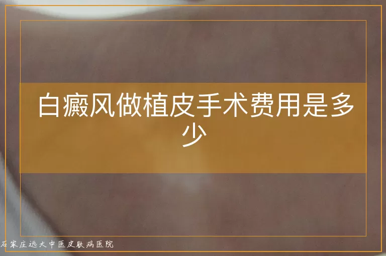 白癜风做植皮手术费用是多少