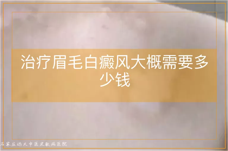 治疗眉毛白癜风大概需要多少钱