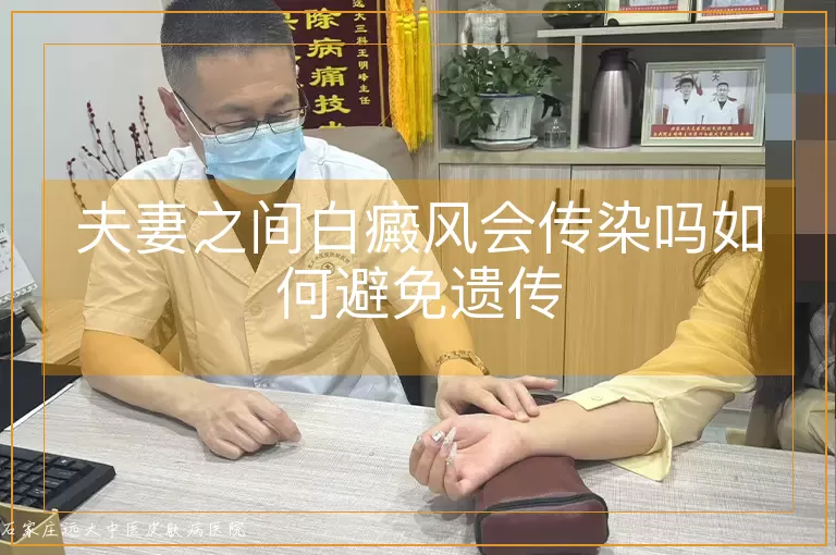 夫妻之间白癜风会传染吗如何避免遗传