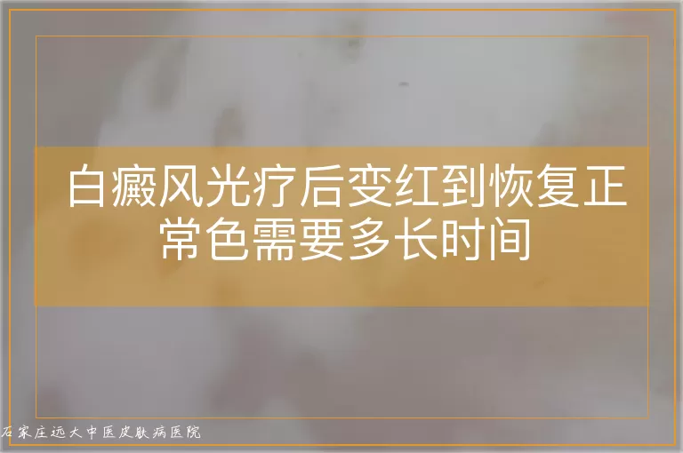 白癜风光疗后变红到恢复正常色需要多长时间
