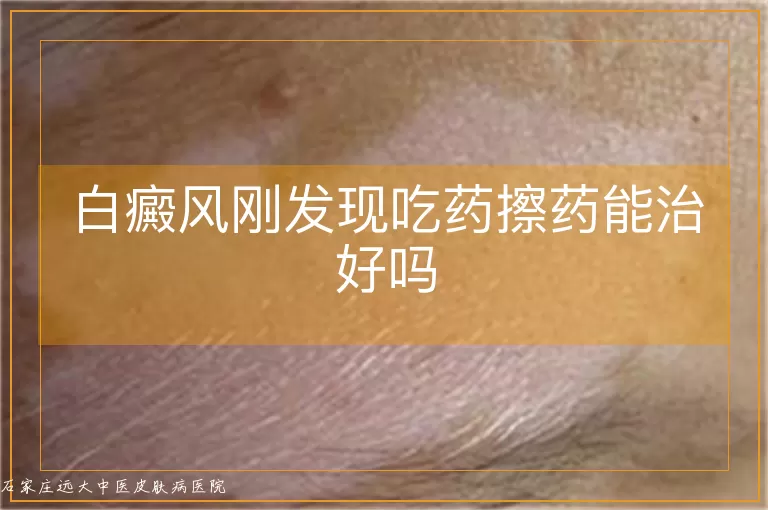 白癜风刚发现吃药擦药能治好吗
