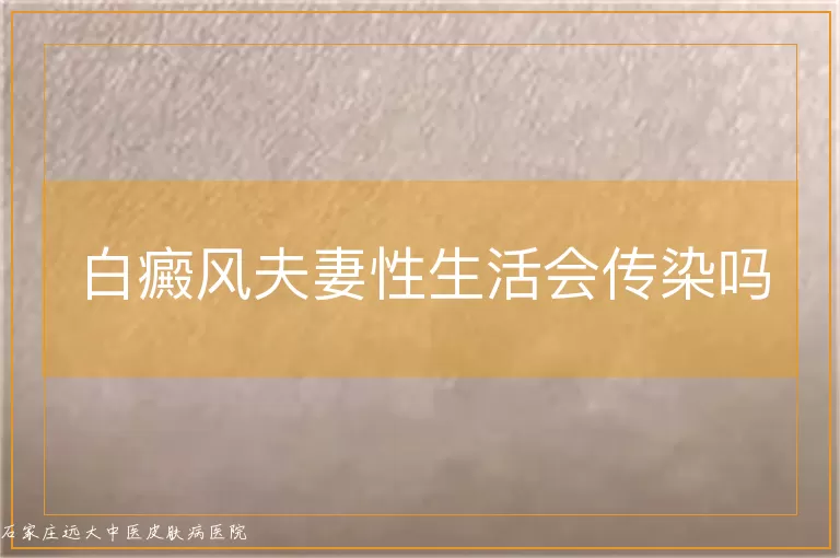 白癜风夫妻性生活会传染吗
