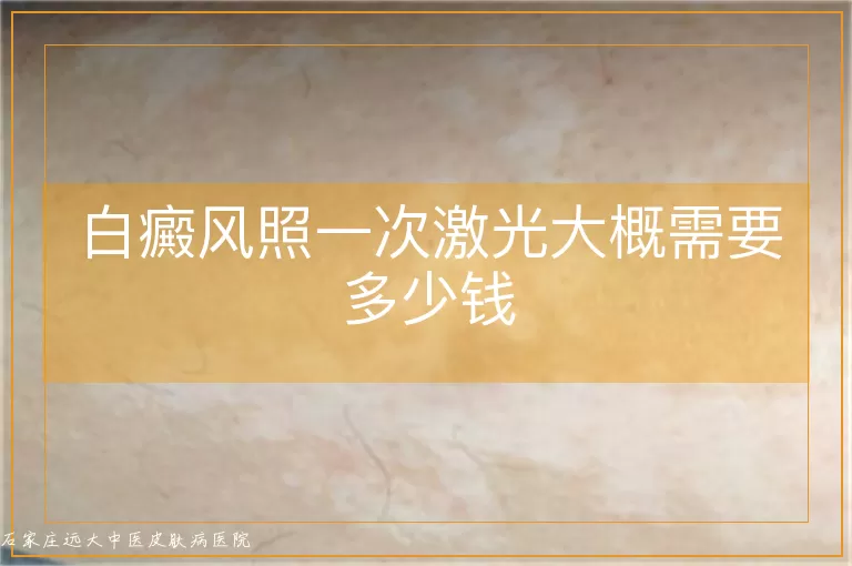 白癜风照一次激光大概需要多少钱