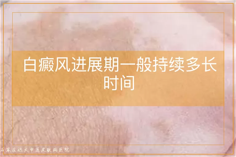 白癜风进展期一般持续多长时间
