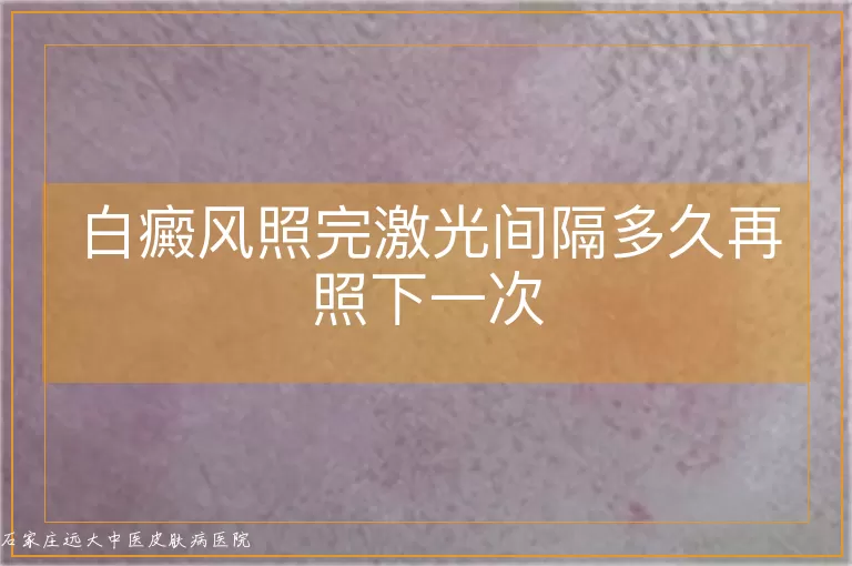 白癜风照完激光间隔多久再照下一次