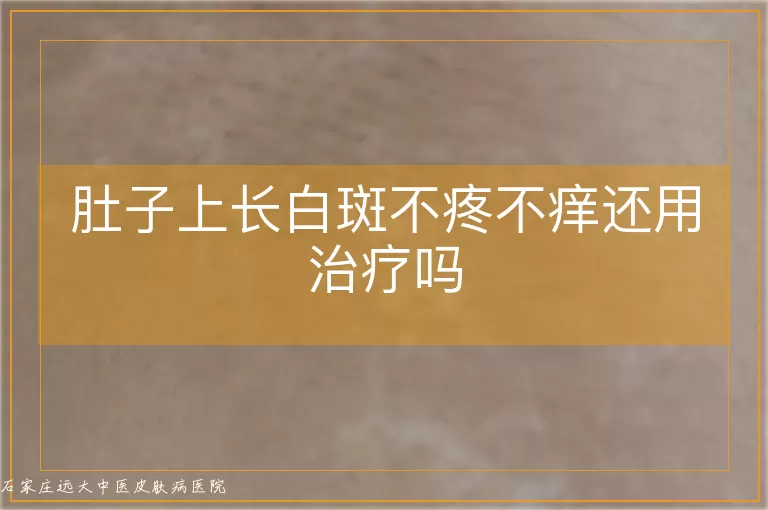 肚子上长白斑不疼不痒还用治疗吗