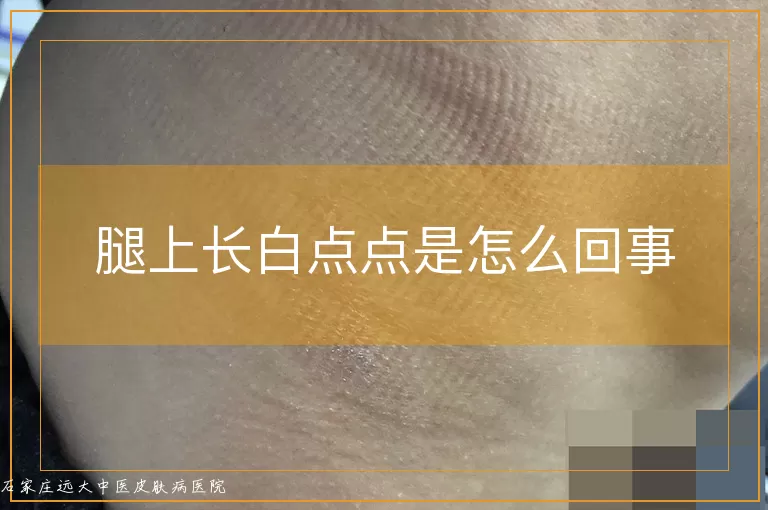 腿上长白点点是怎么回事