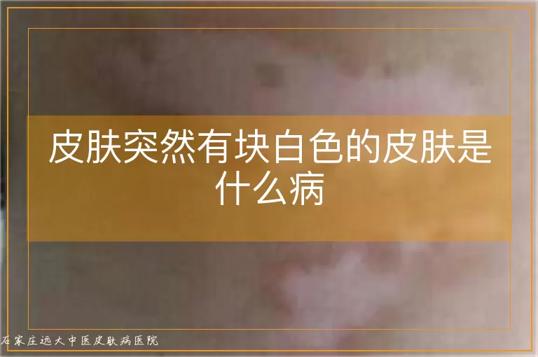 皮肤突然有块白色的皮肤是什么病