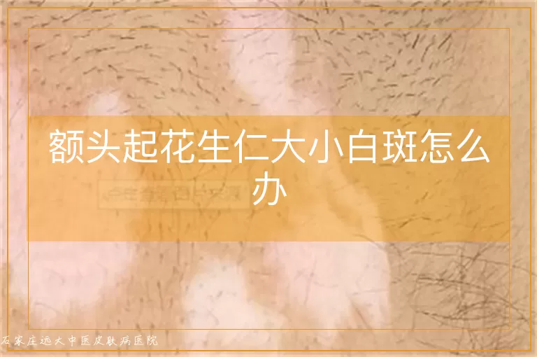 额头起花生仁大小白斑怎么办