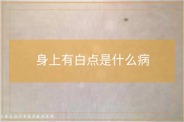 身上有白点是什么病