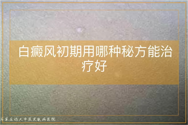 白癜风初期用哪种秘方能治疗好