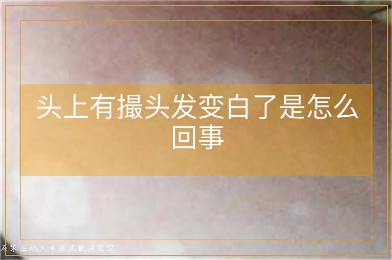 头上有撮头发变白了是怎么回事