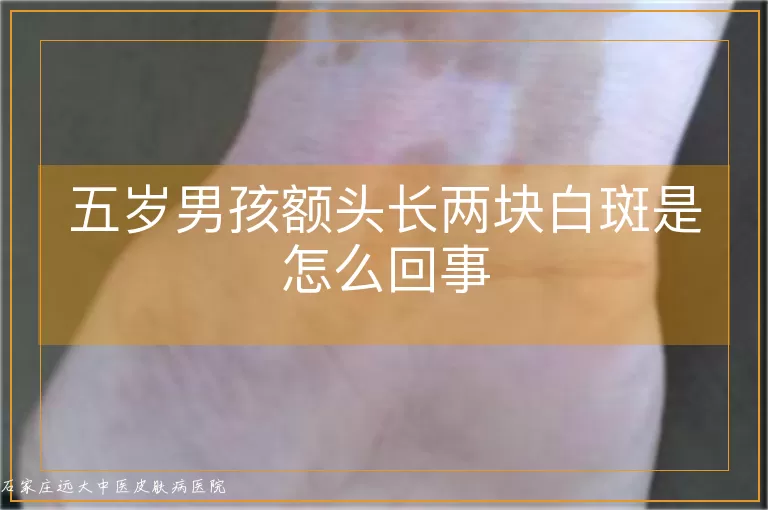 五岁男孩额头长两块白斑是怎么回事