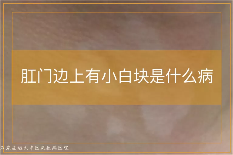 肛门边上有小白块是什么病