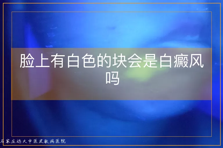 脸上有白色的块会是白癜风吗