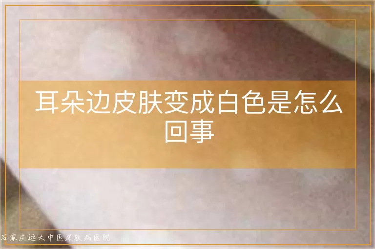 耳朵边皮肤变成白色是怎么回事