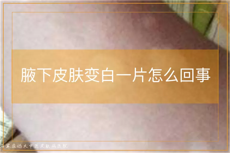 腋下皮肤变白一片怎么回事
