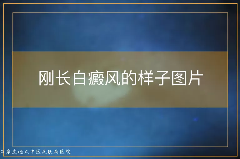 刚长白癜风的样子图片