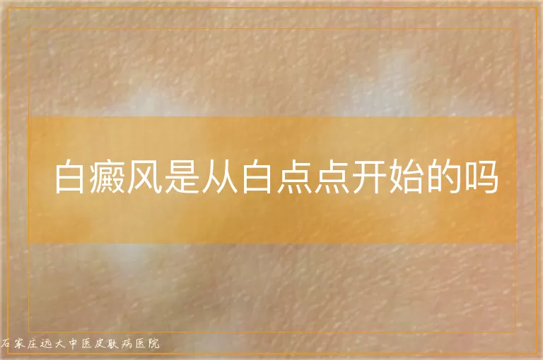 白癜风是从白点点开始的吗