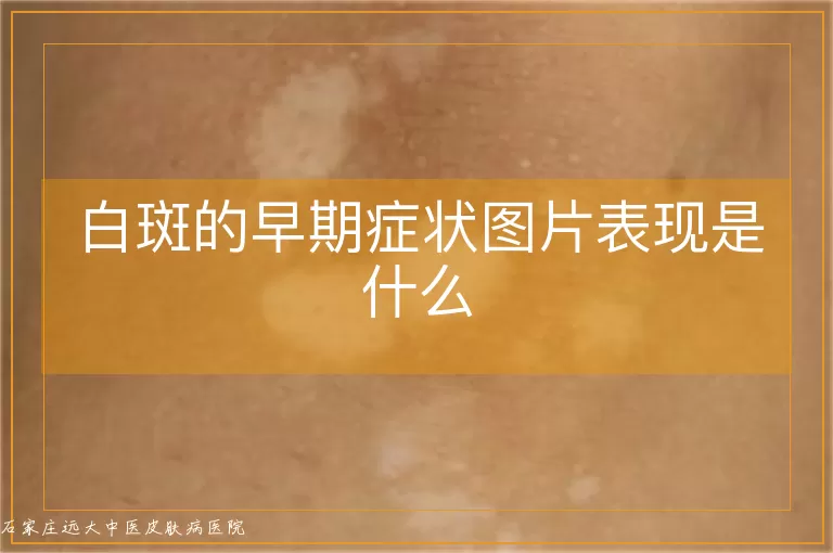 白斑的早期症状图片表现是什么