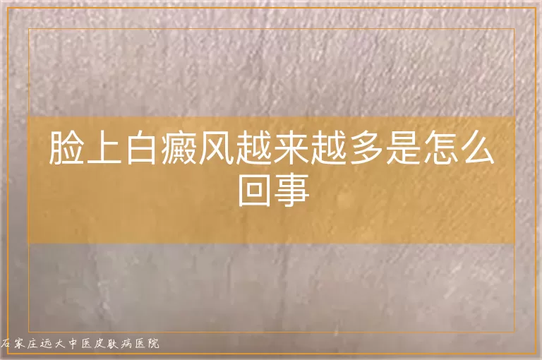 脸上白癜风越来越多是怎么回事