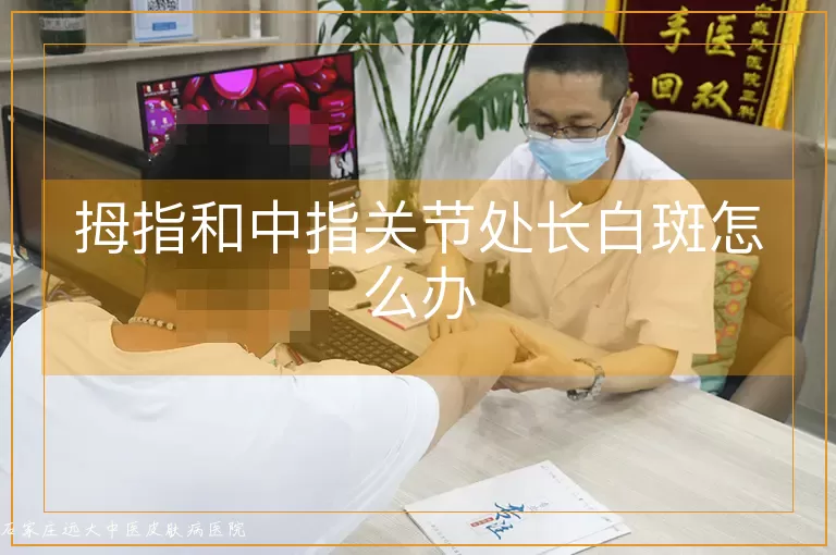 拇指和中指关节处长白斑怎么办