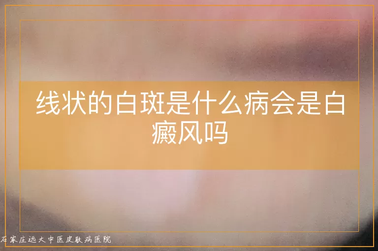 线状的白斑是什么病会是白癜风吗