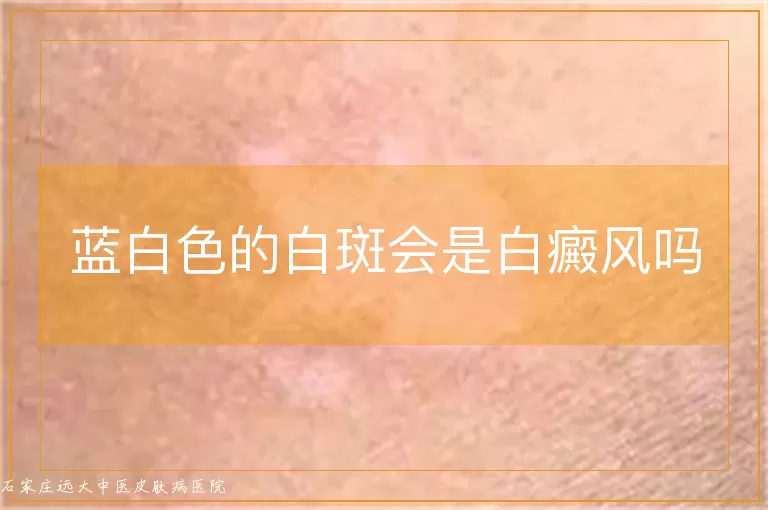 蓝白色的白斑会是白癜风吗