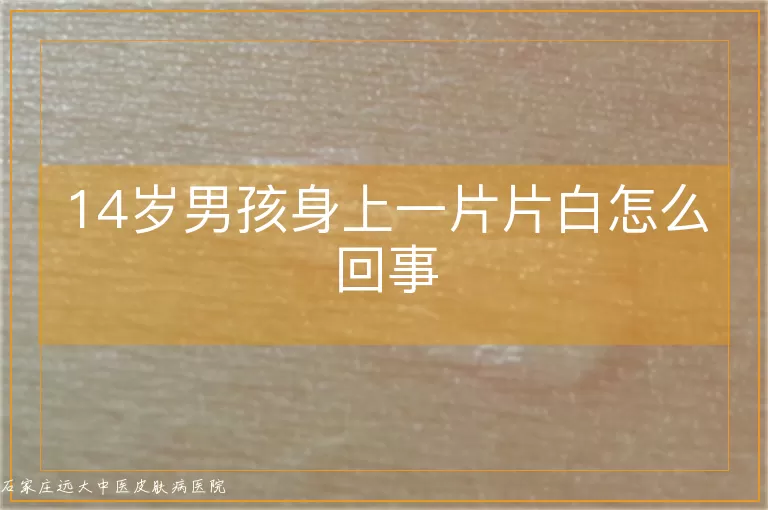 14岁男孩身上一片片白怎么回事