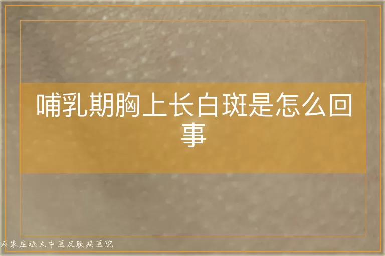 哺乳期胸上长白斑是怎么回事