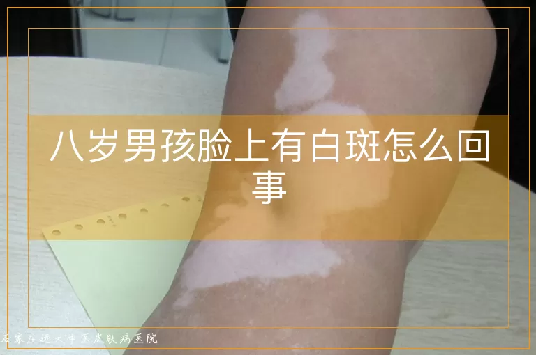 八岁男孩脸上有白斑怎么回事
