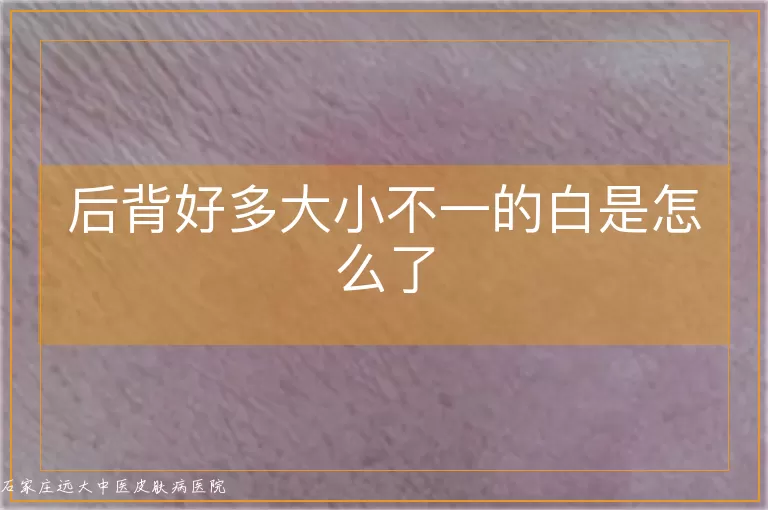 后背好多大小不一的白是怎么了