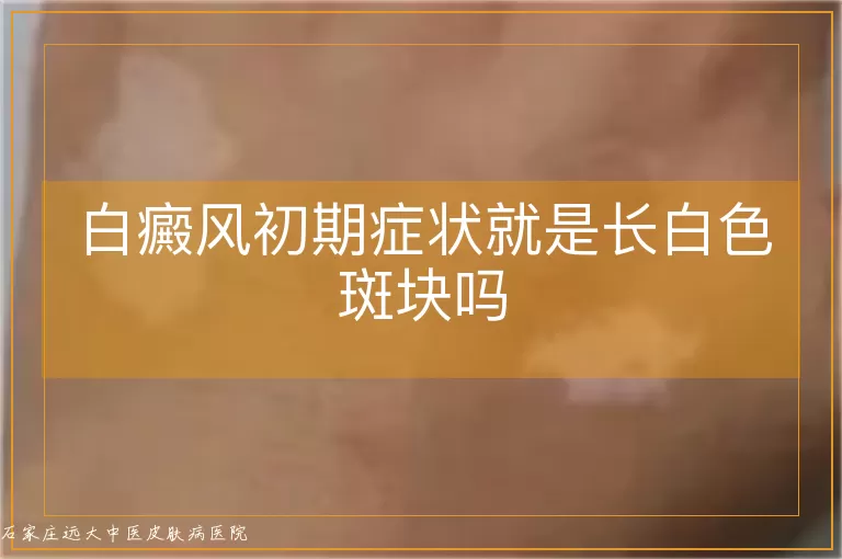 白癜风初期症状就是长白色斑块吗