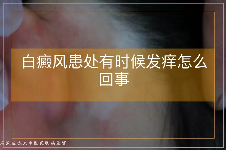 白癜风患处有时候发痒怎么回事