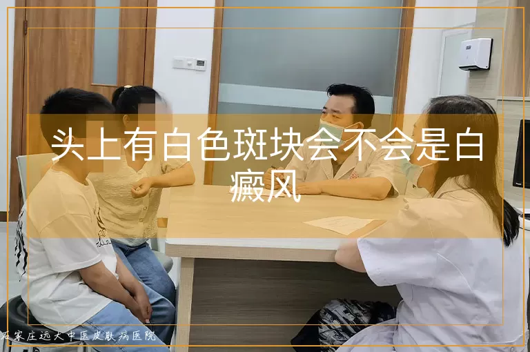 头上有白色斑块会不会是白癜风