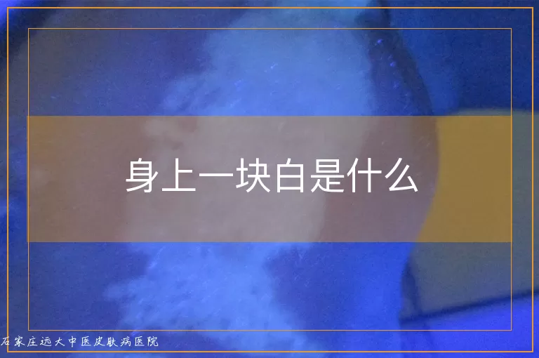 身上一块白是什么