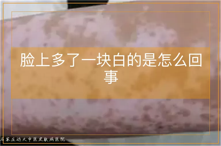 脸上多了一块白的是怎么回事