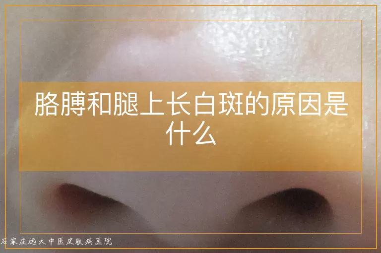 胳膊和腿上长白斑的原因是什么
