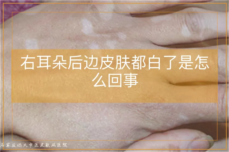 右耳朵后边皮肤都白了是怎么回事