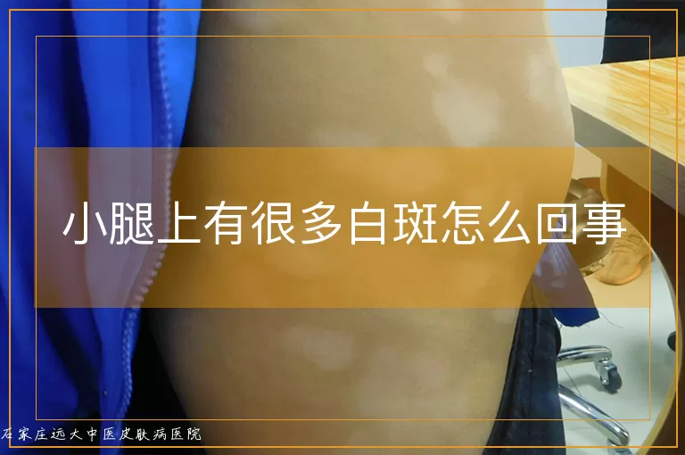 小腿上有很多白斑怎么回事