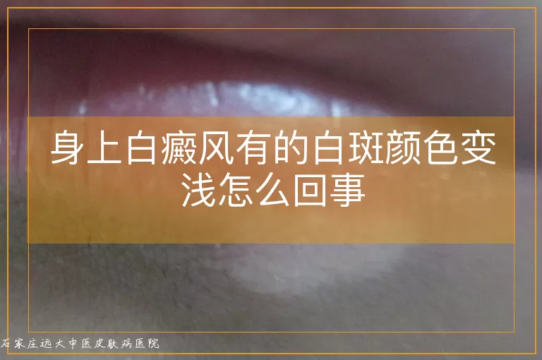身上白癜风有的白斑颜色变浅怎么回事