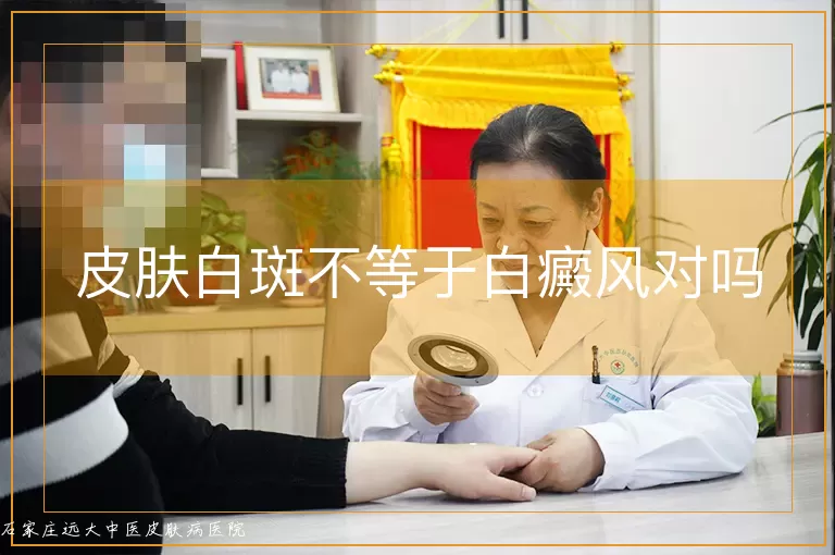 皮肤白斑不等于白癜风对吗