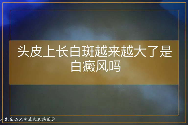 头皮上长白斑越来越大了是白癜风吗