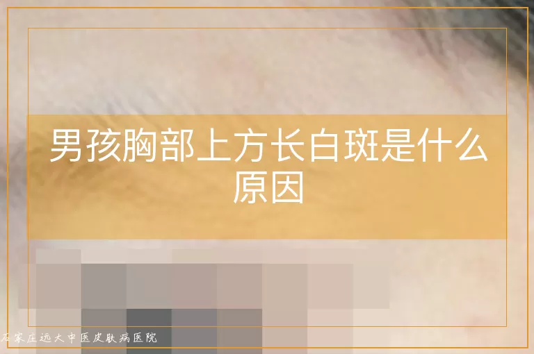 男孩胸部上方长白斑是什么原因